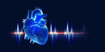 TEE is becoming an integral part of cardiac surgeries-Dr. Shweta Yemul Golhar