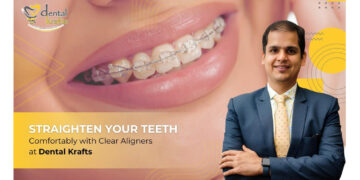 Straighten Your Teeth Comfortably with Clear Aligners at Dental Krafts