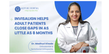 Invisalign Treatment Delivers Predictable Results for Adult Patients, Achieving Complete Space Closure in as Little as 8 Months