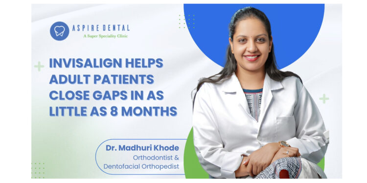 Invisalign Treatment Delivers Predictable Results for Adult Patients, Achieving Complete Space Closure in as Little as 8 Months