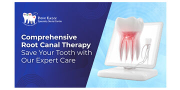 Comprehensive Root Canal Therapy at Dent Eazee: Save Your Tooth with Our Expert Care